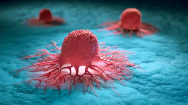 cellules cancer